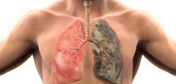 Негативні наслідки здоров’я від куріння. Чому варто відмовитися від шкідливої звички